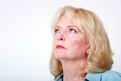 Rosacea en Medellin Colombia